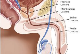 Üretra Hastalıkları